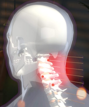 Neck Elevation